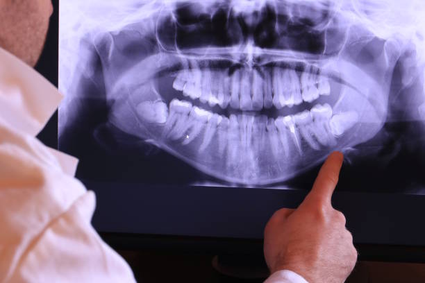Best Emergency Dental Care for Trauma or Injury in Westmont, NJ
